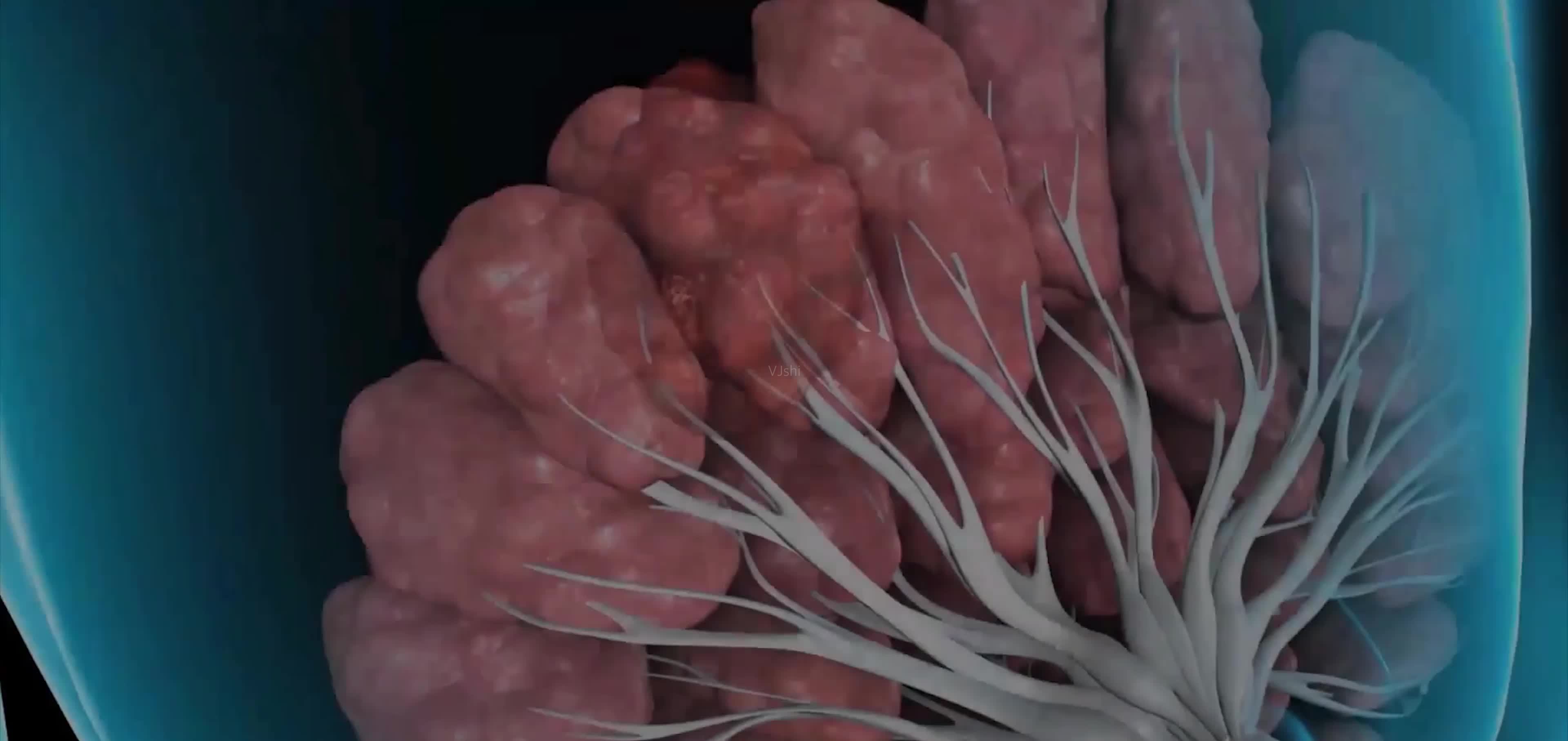3D 打印在抗击乳腺癌中的应用