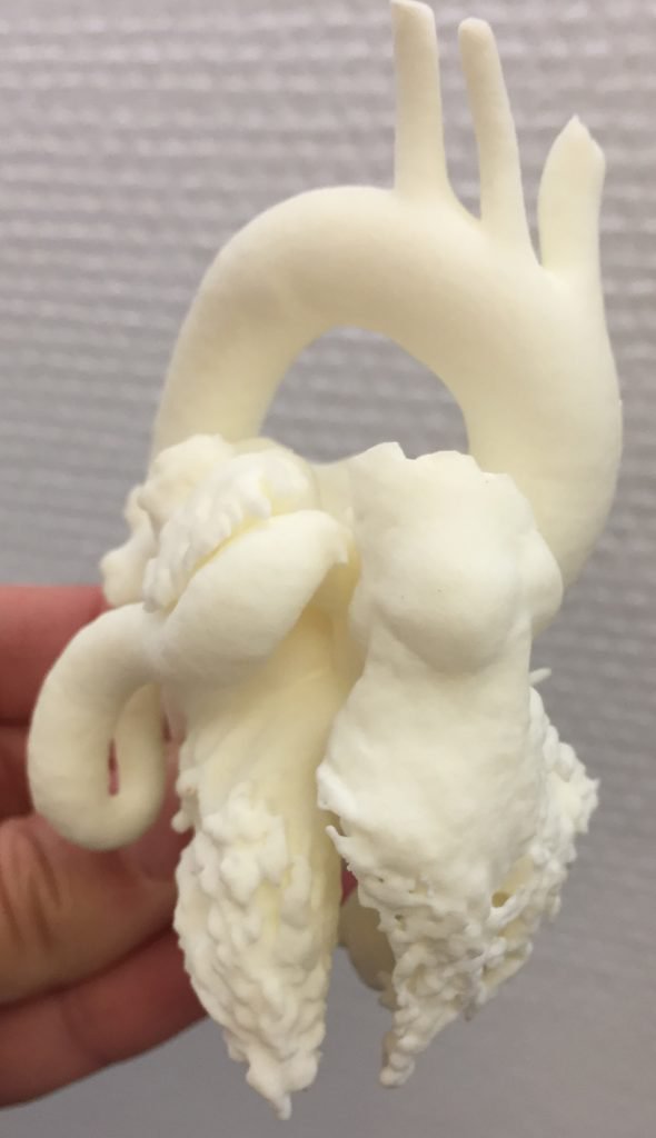 使用GE的AW VolumeShare实现印刷的婴儿心脏，以加速3D打印过程